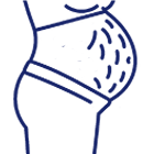 ترک پوستی 485485